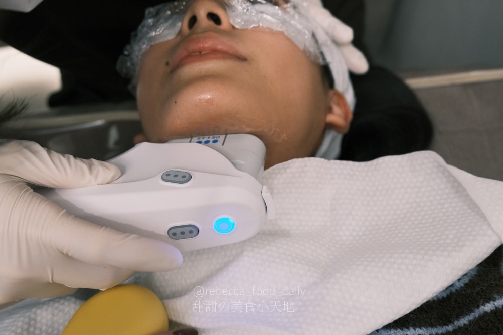 【首爾醫美推薦】明洞奧緹娜 Otena Clinic 實測:眼下麗珠蘭告別黑眼圈,美版超聲刀拉出逆天下顎線! - 第8張圖 【首爾醫美推薦】明洞奧緹娜 Otena Clinic 實測:眼下麗珠蘭告別黑眼圈,美版超聲刀拉出逆天下顎線!