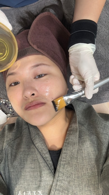 【首爾醫美推薦】江南詩麗雅 Xenia Clinic 實測|雙下巴救星ONDA、麗珠蘭機打黃金微針,價格透明不推銷! - 第33張圖 【首爾醫美推薦】江南詩麗雅 Xenia Clinic 實測|雙下巴救星ONDA、麗珠蘭機打黃金微針,價格透明不推銷!