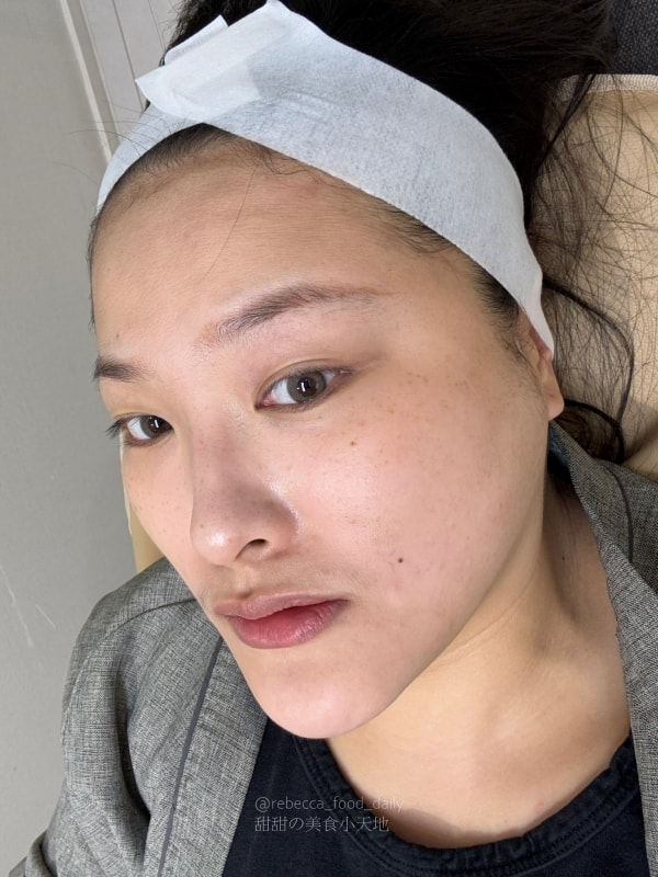 【首爾醫美推薦】江南詩麗雅 Xenia Clinic 實測|雙下巴救星ONDA、麗珠蘭機打黃金微針,價格透明不推銷! - 第39張圖 【首爾醫美推薦】江南詩麗雅 Xenia Clinic 實測|雙下巴救星ONDA、麗珠蘭機打黃金微針,價格透明不推銷!