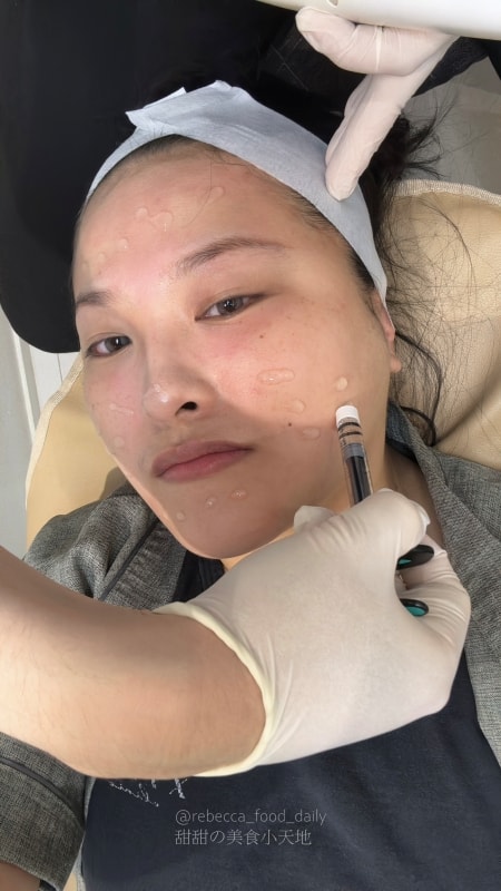 【首爾醫美推薦】江南詩麗雅 Xenia Clinic 實測|雙下巴救星ONDA、麗珠蘭機打黃金微針,價格透明不推銷! - 第27張圖 【首爾醫美推薦】江南詩麗雅 Xenia Clinic 實測|雙下巴救星ONDA、麗珠蘭機打黃金微針,價格透明不推銷!