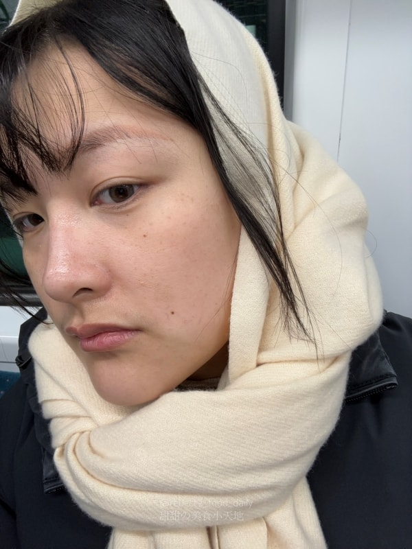 【首爾醫美推薦】江南詩麗雅 Xenia Clinic 實測|雙下巴救星ONDA、麗珠蘭機打黃金微針,價格透明不推銷! - 第30張圖 【首爾醫美推薦】江南詩麗雅 Xenia Clinic 實測|雙下巴救星ONDA、麗珠蘭機打黃金微針,價格透明不推銷!