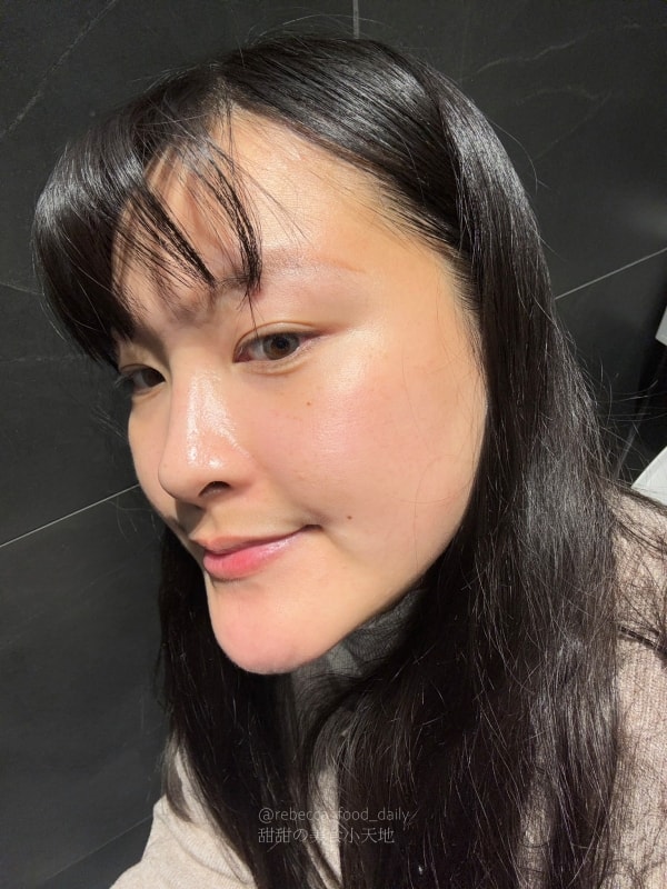 【首爾醫美推薦】江南詩麗雅 Xenia Clinic 實測|雙下巴救星ONDA、麗珠蘭機打黃金微針,價格透明不推銷! - 第31張圖 【首爾醫美推薦】江南詩麗雅 Xenia Clinic 實測|雙下巴救星ONDA、麗珠蘭機打黃金微針,價格透明不推銷!